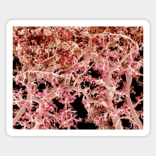 Kidney blood vessels, SEM (C022/7915) Sticker